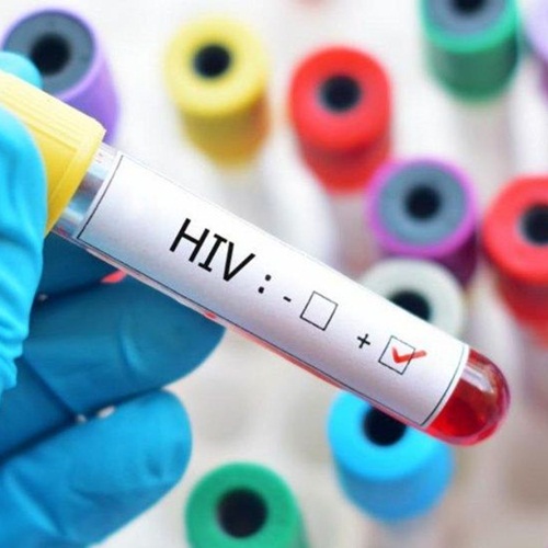 #TercerTiempo | Eduardo López, infectólogo, sobre la cura del HIV